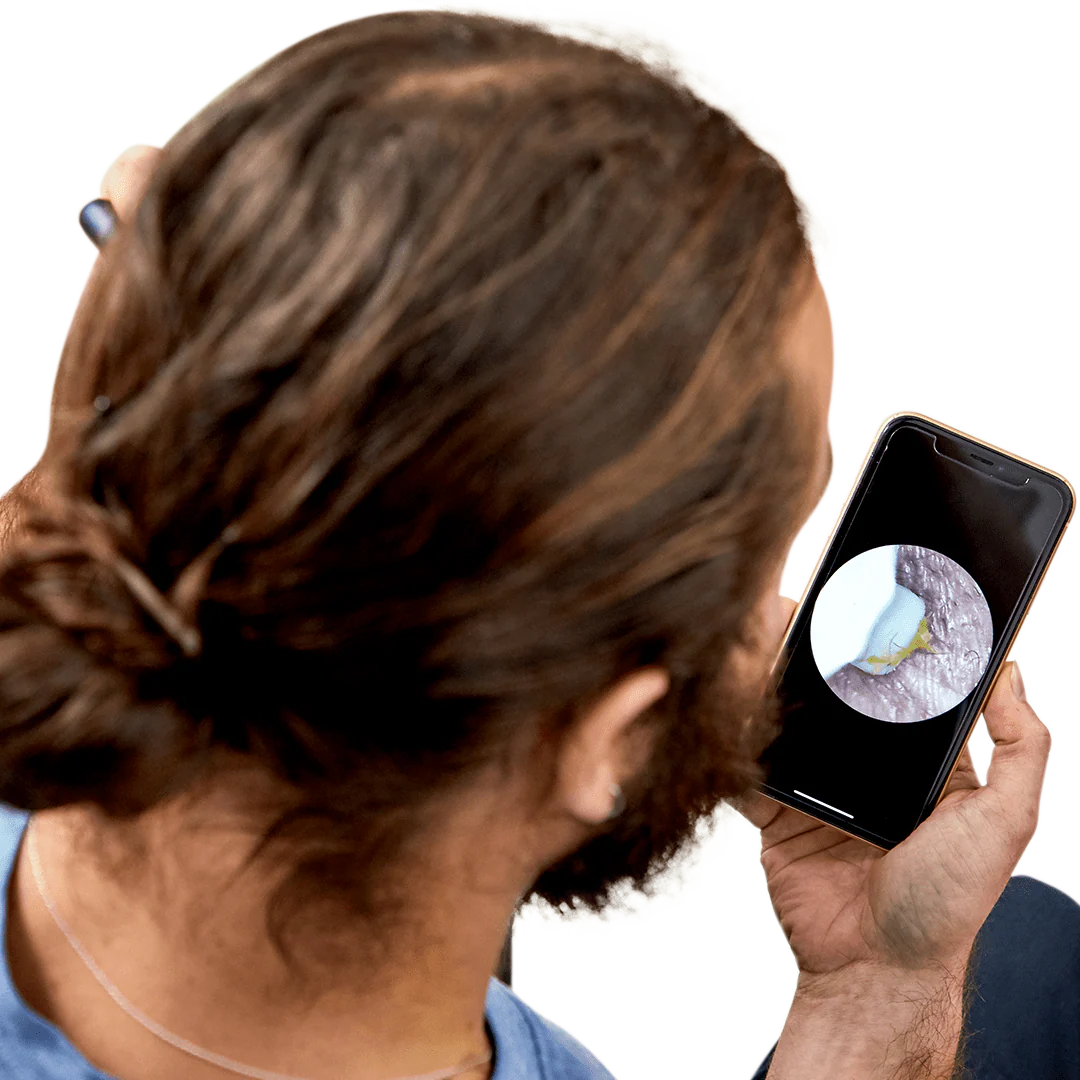 Auriview - Čistič uší s kamerkou