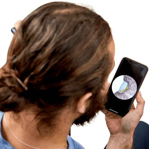 Auriview - Čistič uší s kamerkou